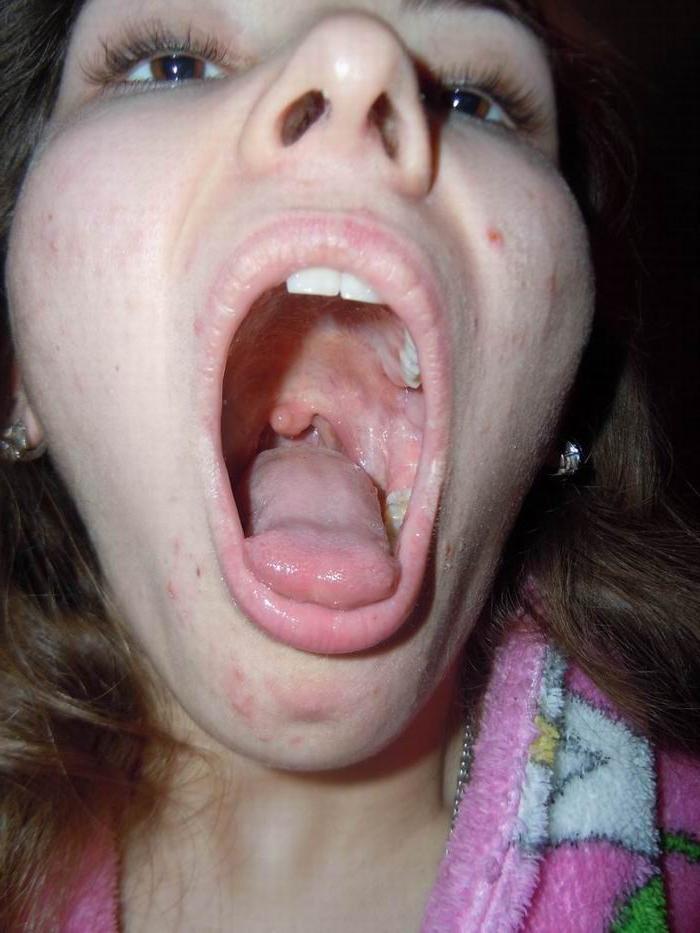 16P amateurs take a huge load by their long tongues