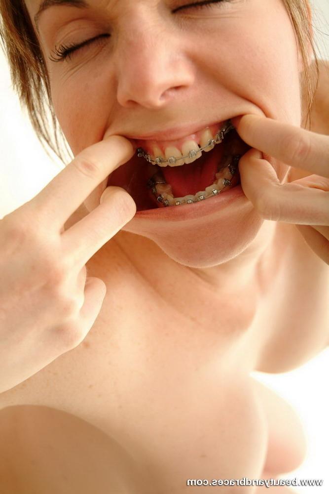 16P Cute minx spreads her cock hungry mouth open to show sexy braces