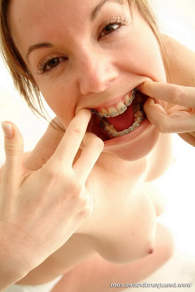16P Cute minx spreads her cock hungry mouth open to show sexy braces