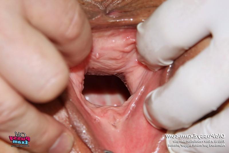 15P Verka mature fetish gyno speculum examination