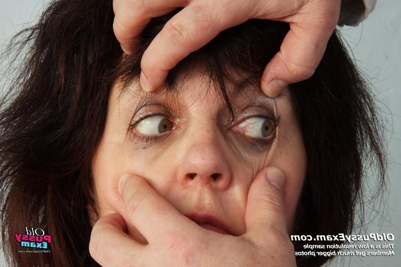 15P Radima mature pussy gyno speculum doctor exam