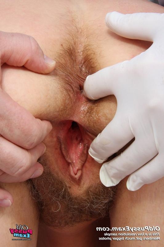 15P Linda mature fetish pussy gaping speculum doctor