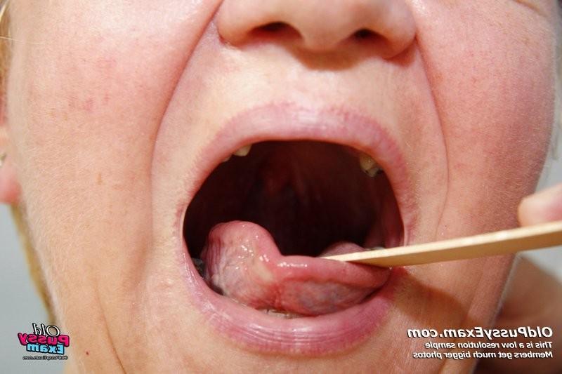 15P Fat old Radka mature pussy gyno speculum exam on gynochair
