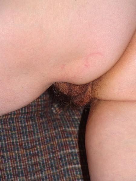 17P Dense older stretched hirsute pussy