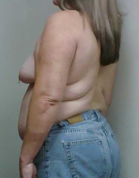 13P Wife breast aug consultation 04