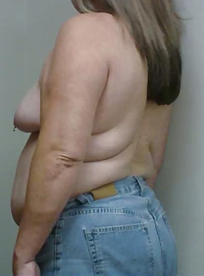 13P Wife breast aug consultation 04