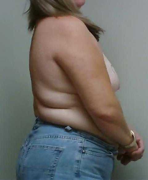 13P Wife breast aug consultation 04