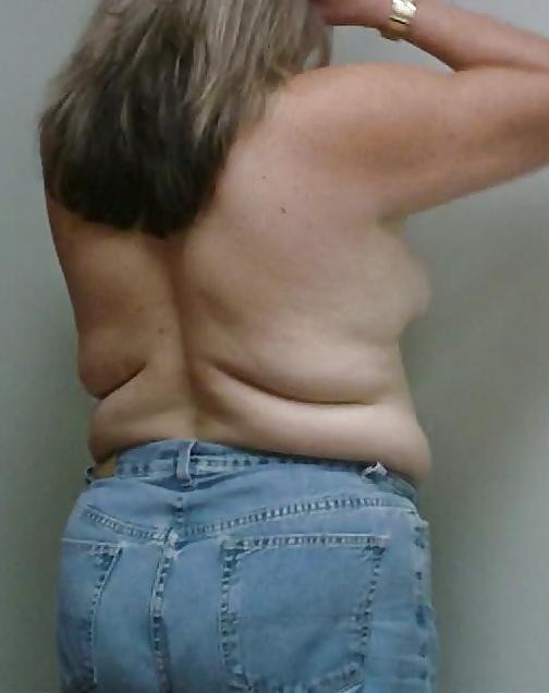 13P Wife breast aug consultation 04