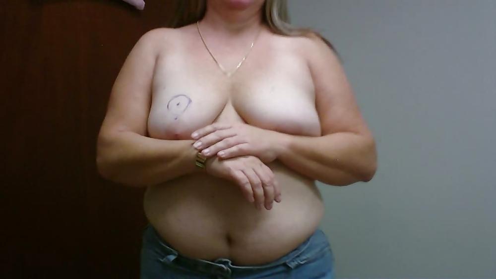13P Wife breast aug consultation 04