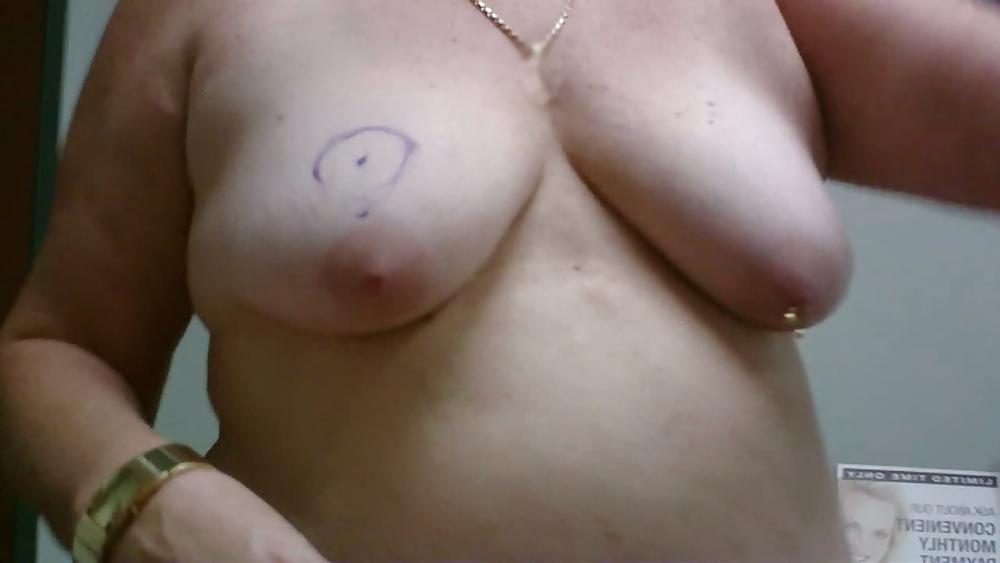 13P Wife breast aug consultation 04