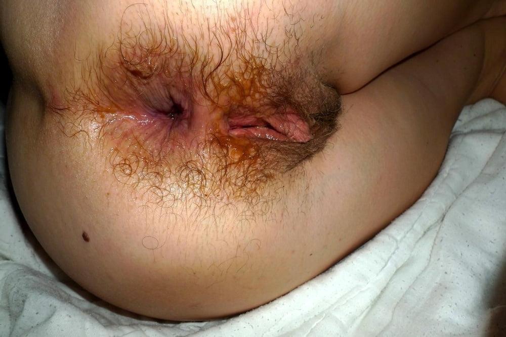 25P unwashed dirty asshole