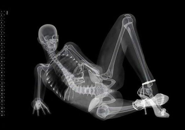13P Erotic Calendar 13 - X-ray Calender 2010