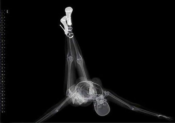 13P Erotic Calendar 13 - X-ray Calender 2010
