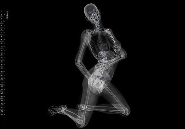 13P Erotic Calendar 13 - X-ray Calender 2010