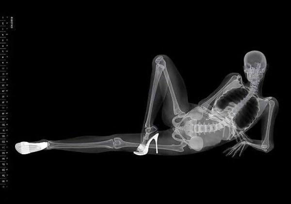 13P Erotic Calendar 13 - X-ray Calender 2010