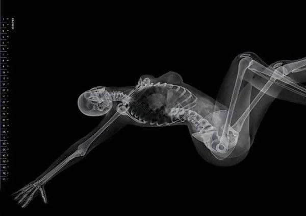 13P Erotic Calendar 13 - X-ray Calender 2010