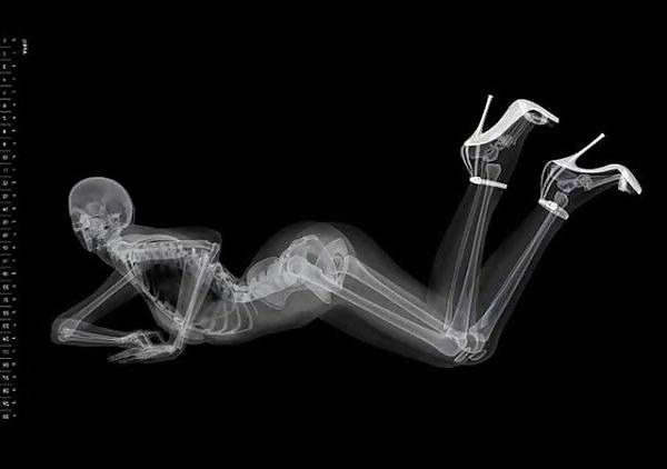 13P Erotic Calendar 13 - X-ray Calender 2010