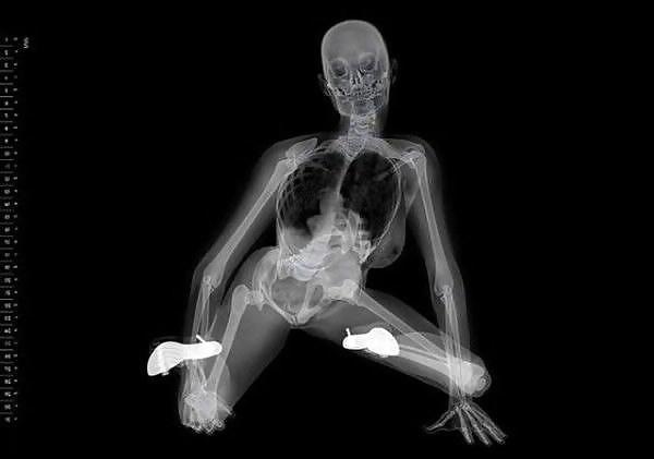 13P Erotic Calendar 13 - X-ray Calender 2010