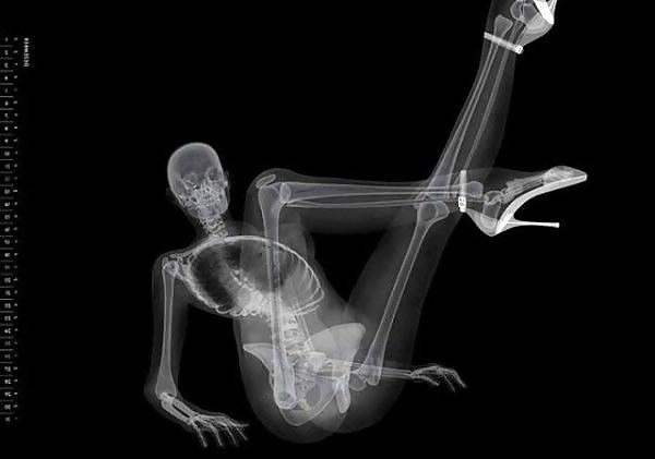 13P Erotic Calendar 13 - X-ray Calender 2010