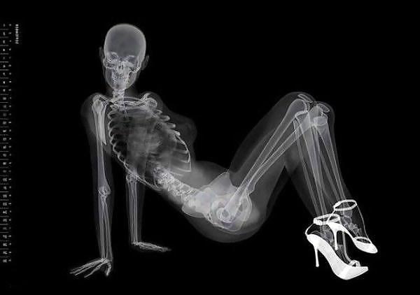 13P Erotic Calendar 13 - X-ray Calender 2010