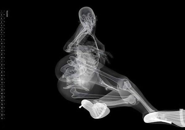 13P Erotic Calendar 13 - X-ray Calender 2010