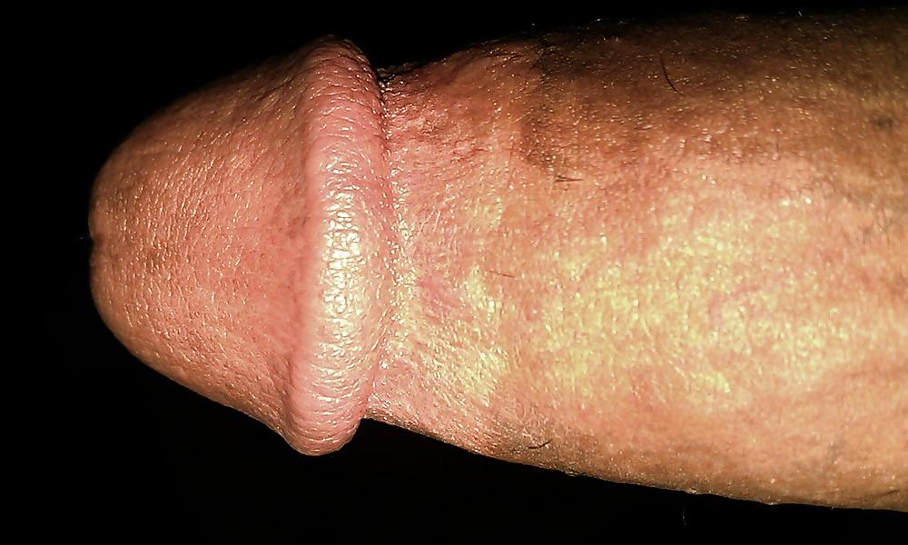 17P Il mio pene