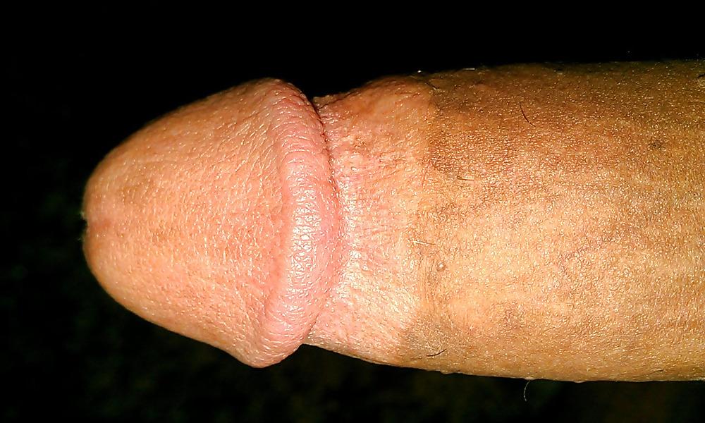 17P Il mio pene