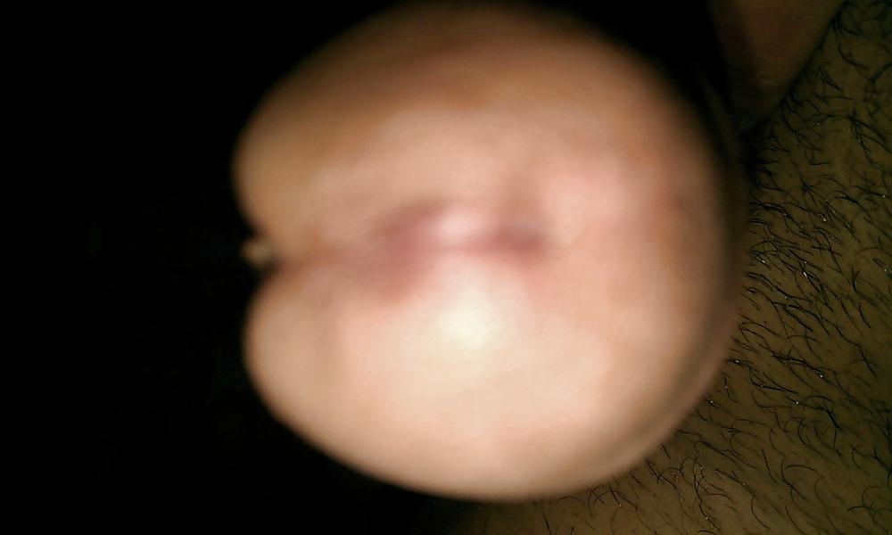 17P Il mio pene