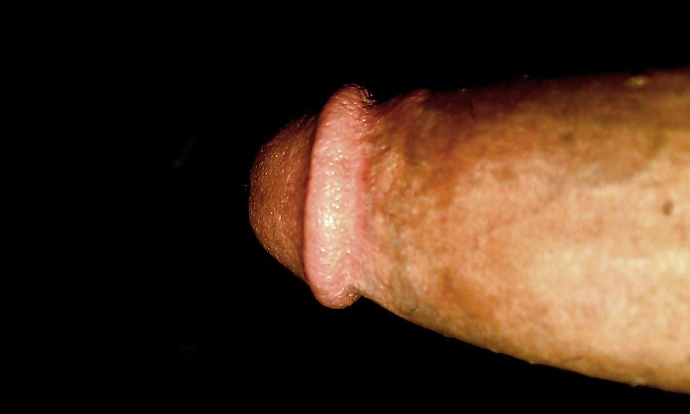 17P Il mio pene
