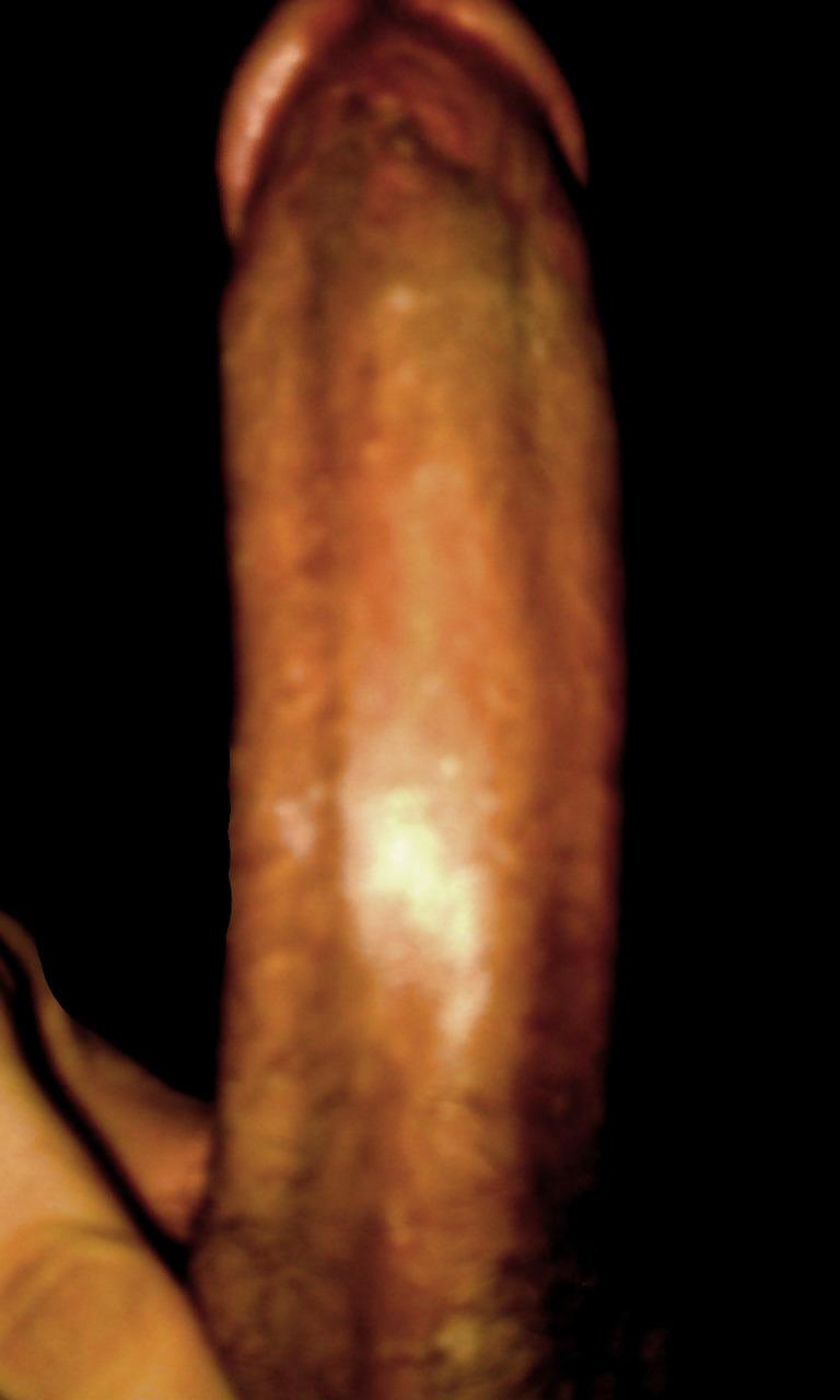 17P Il mio pene
