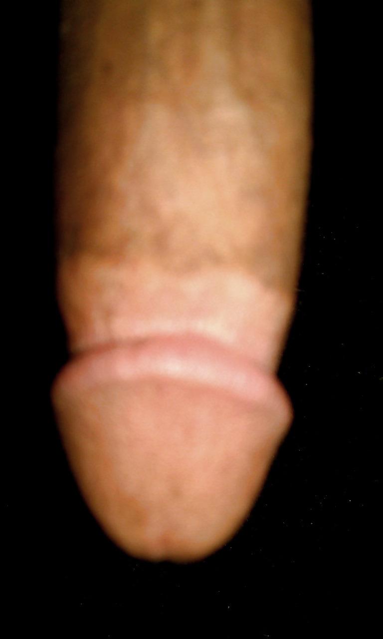17P Il mio pene