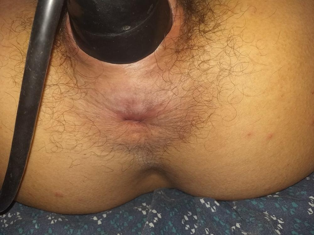 25P GAPING HAIRY PUSSY &amp; ASSHOLE