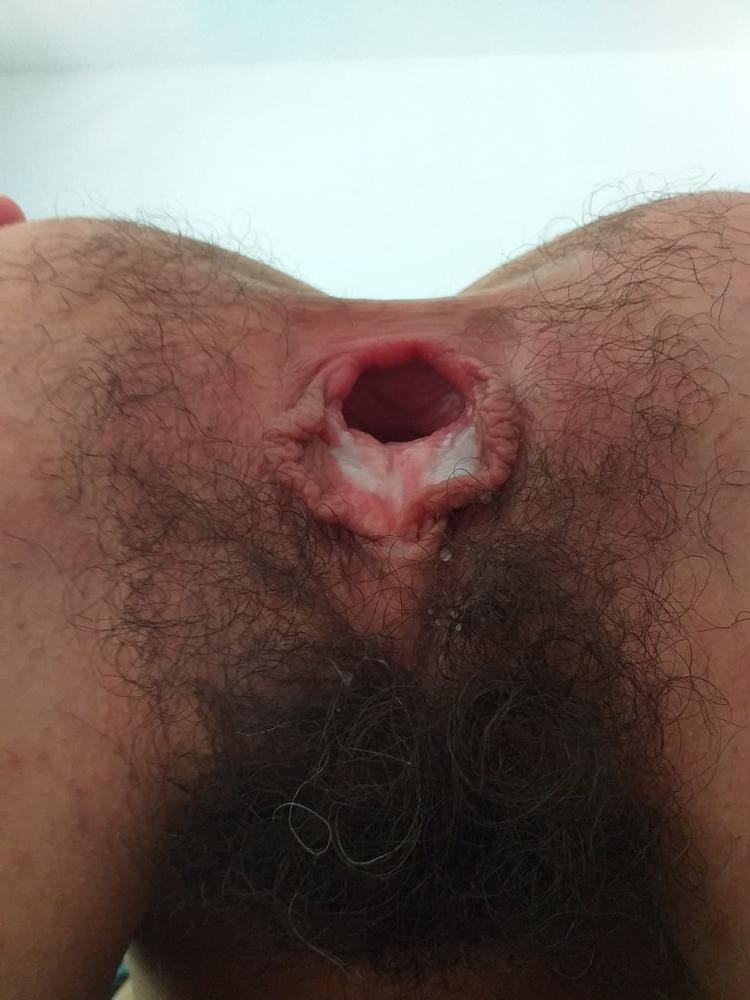 25P GAPING HAIRY PUSSY &amp; ASSHOLE