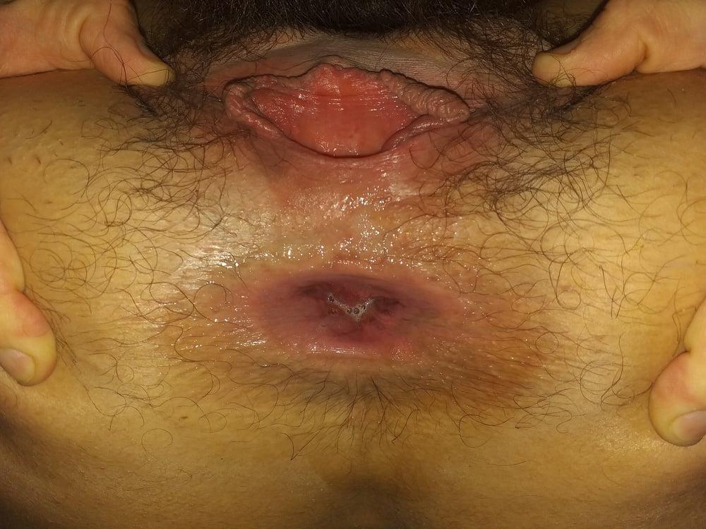 25P GAPING HAIRY PUSSY &amp; ASSHOLE