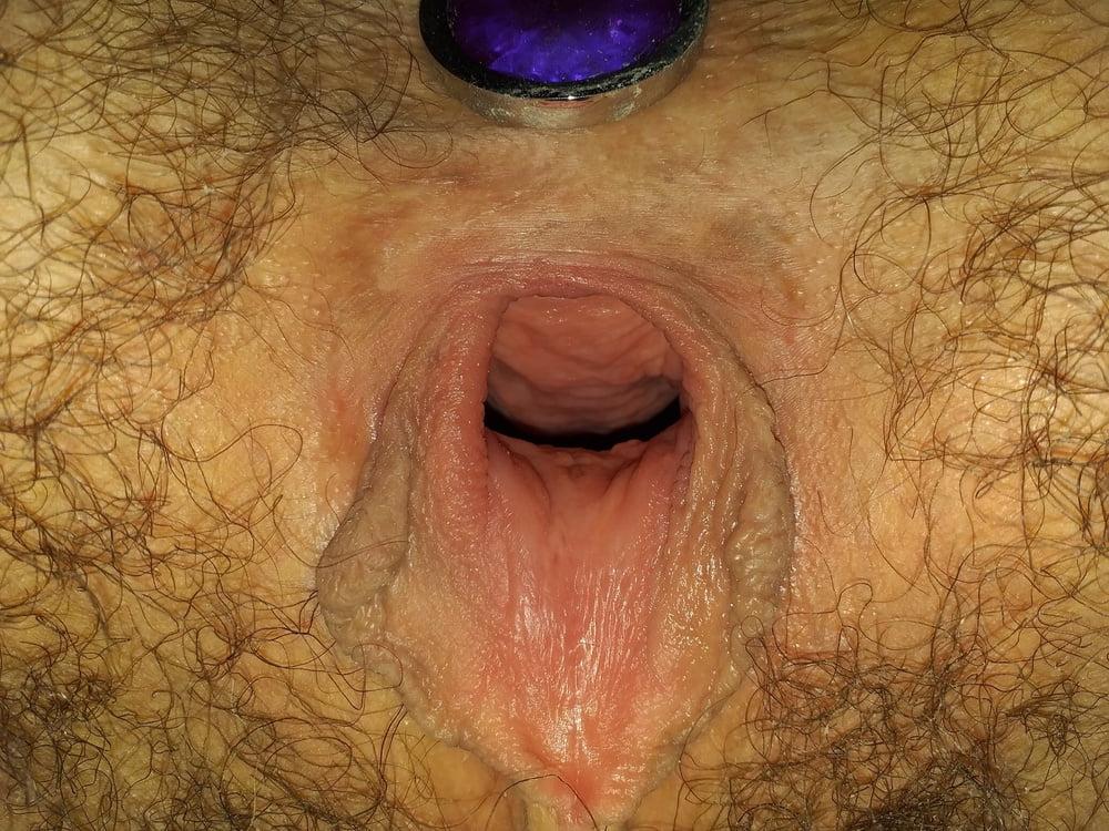 25P GAPING HAIRY PUSSY &amp; ASSHOLE