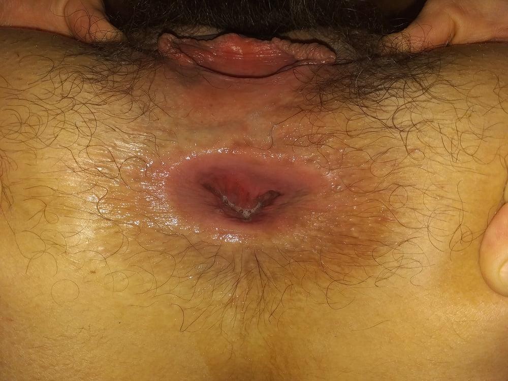 25P GAPING HAIRY PUSSY &amp; ASSHOLE