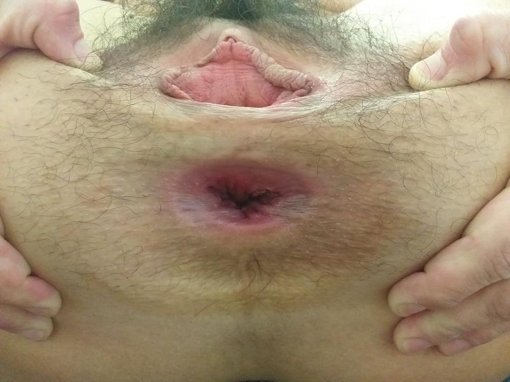25P GAPING HAIRY PUSSY &amp; ASSHOLE