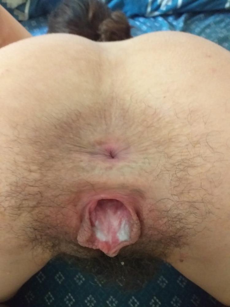 25P GAPING HAIRY PUSSY &amp; ASSHOLE