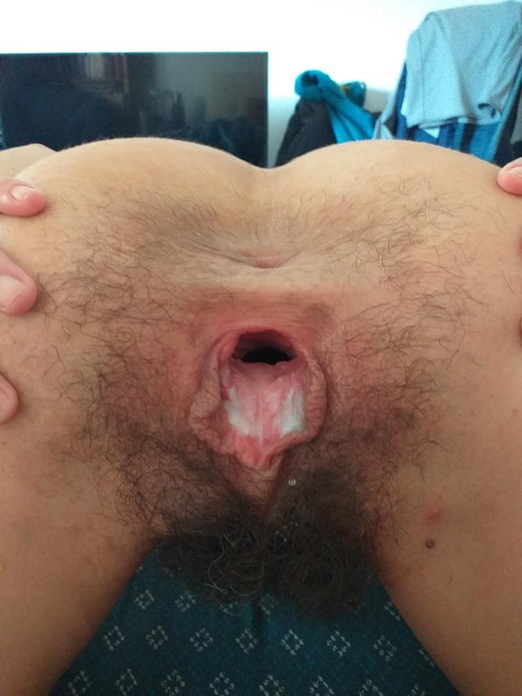 25P GAPING HAIRY PUSSY &amp; ASSHOLE