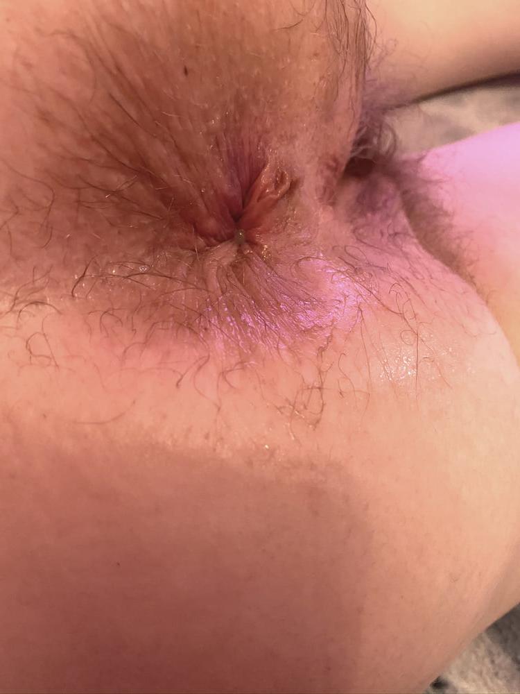 8P My tight asshole getting fucked - Milf anal