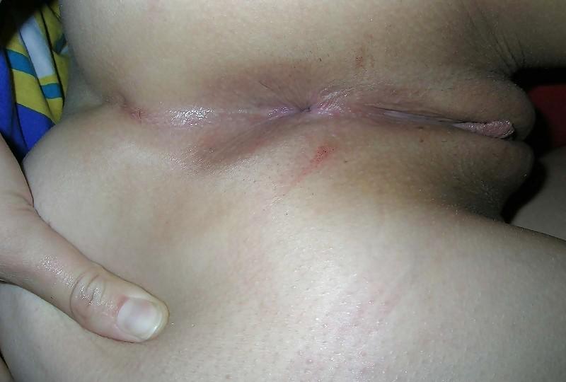 25P Asshole and pussy