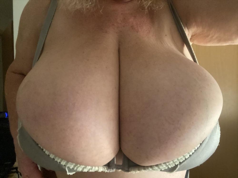 25P Macromastia Monster Tits