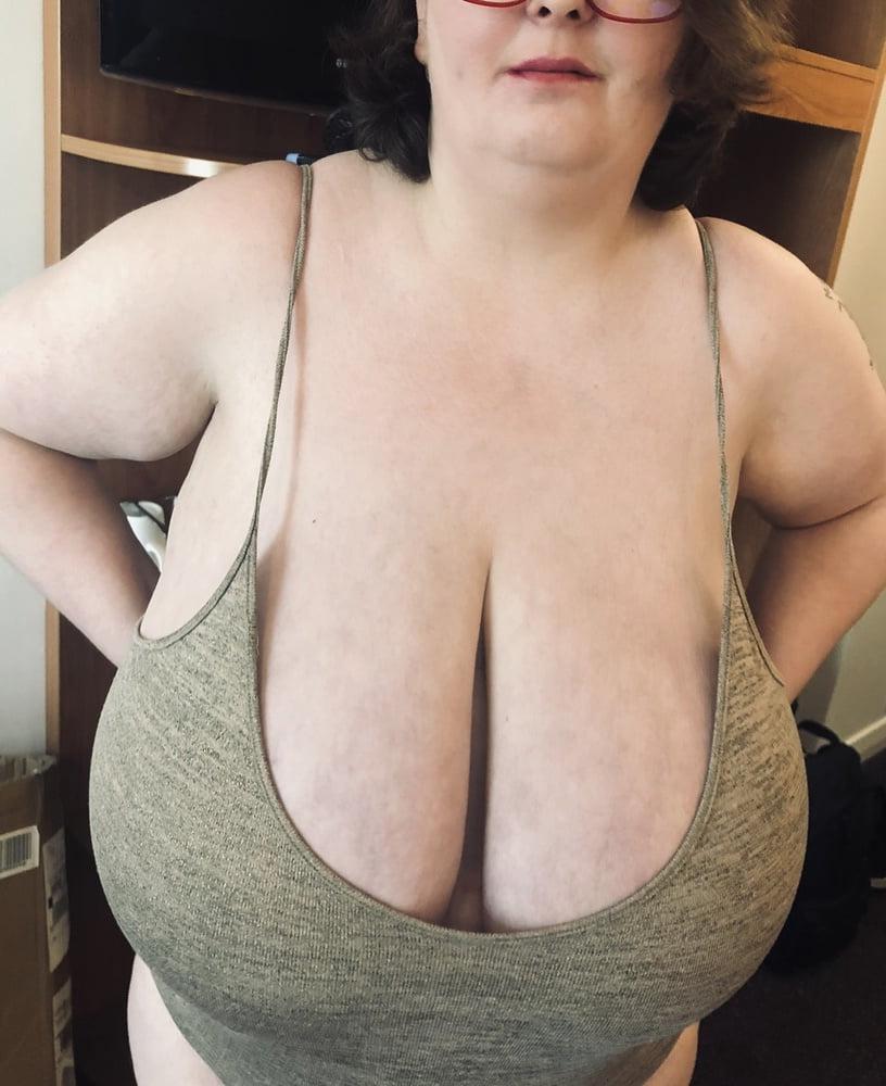 25P Macromastia Monster Tits