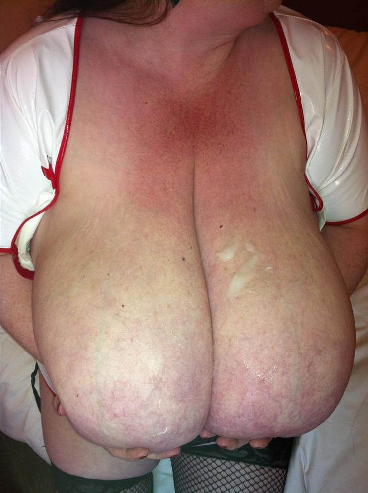 25P Macromastia Monster Tits