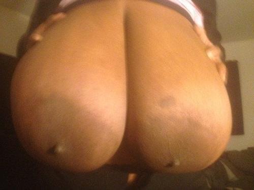 25P Macromastia Monster Tits