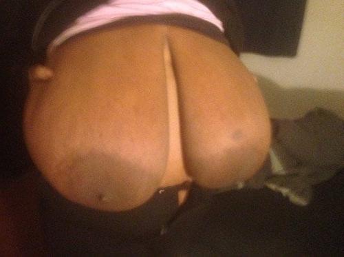 25P Macromastia Monster Tits