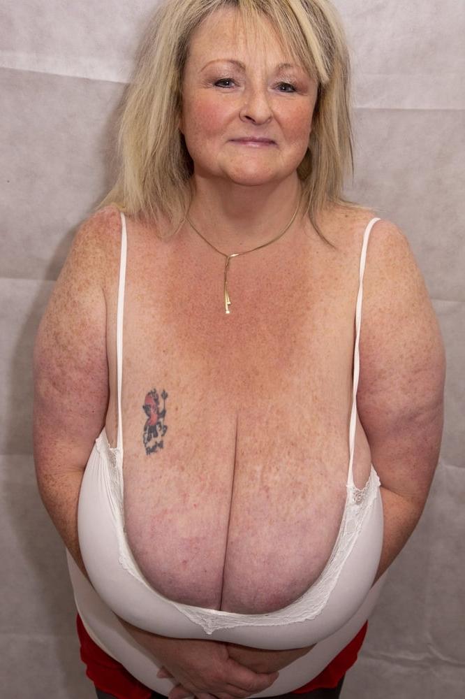 25P Macromastia Monster Tits