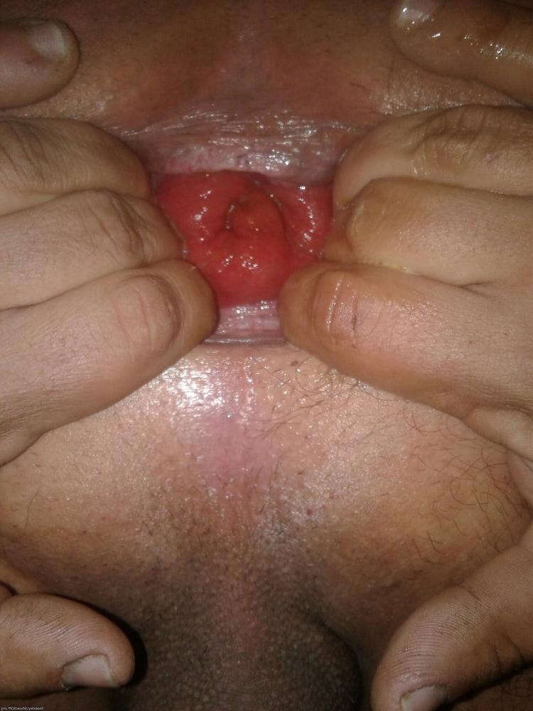 25P My asshole in different stages