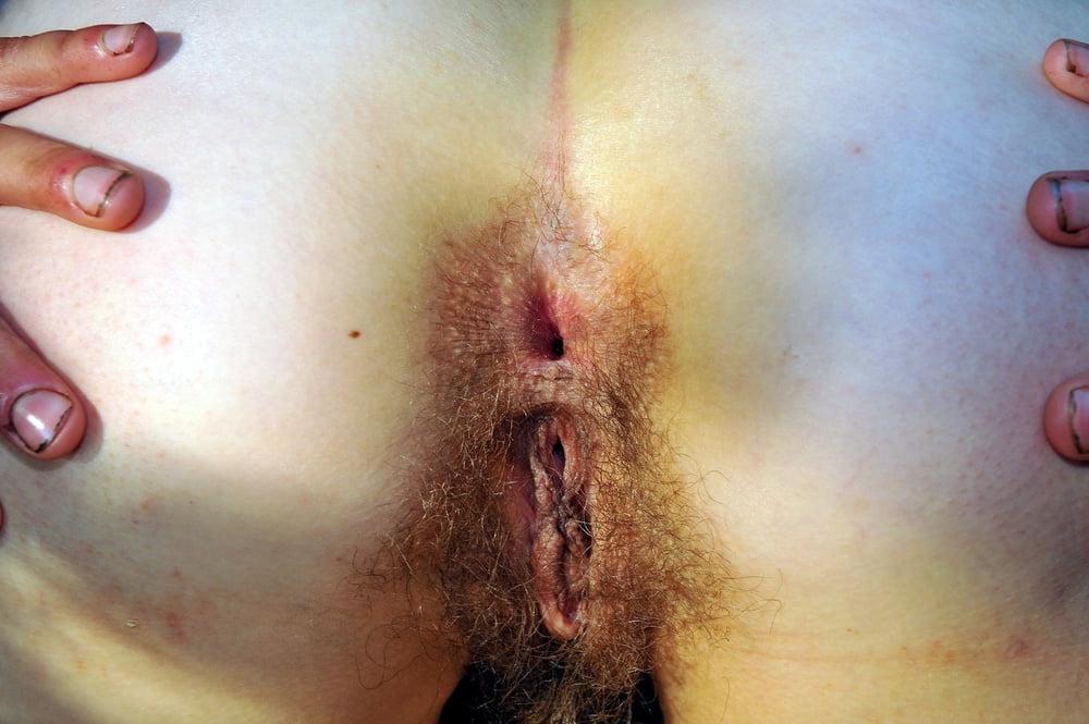 25P Nature Type Neo-Hippie Girl with Gaping Asshole