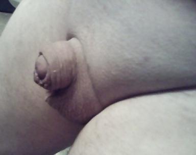 20P Tiny